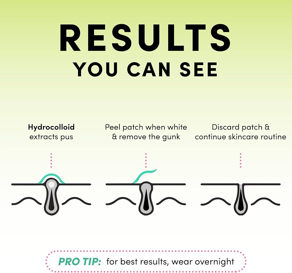 PoreClean - Acne Patch met Hydrocolloid voor een gezonde huid in één nacht