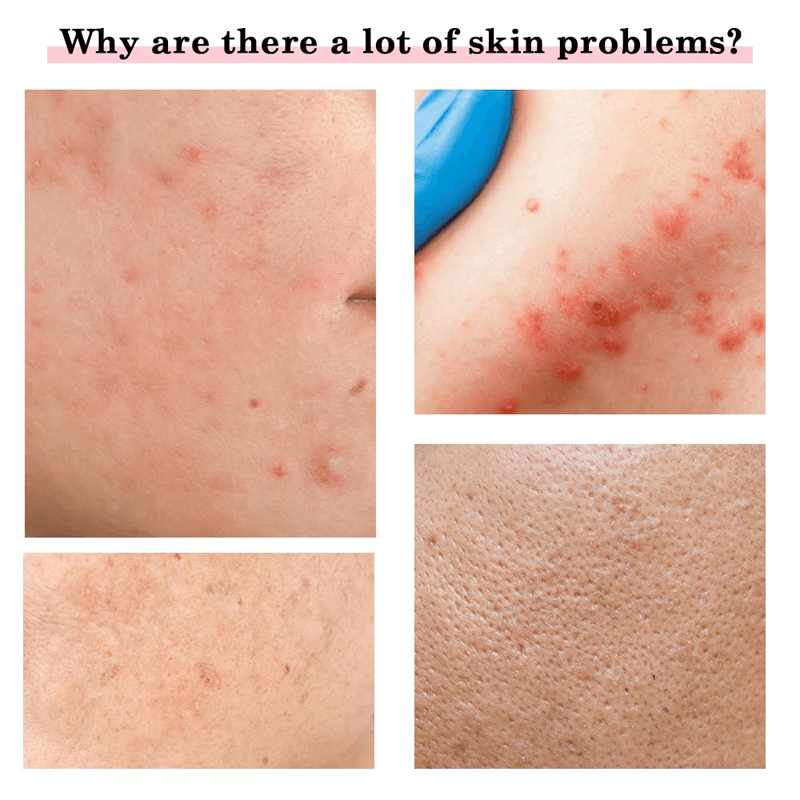 Multifunctionele Gezichtsverzorging Massager Anti Veroudering