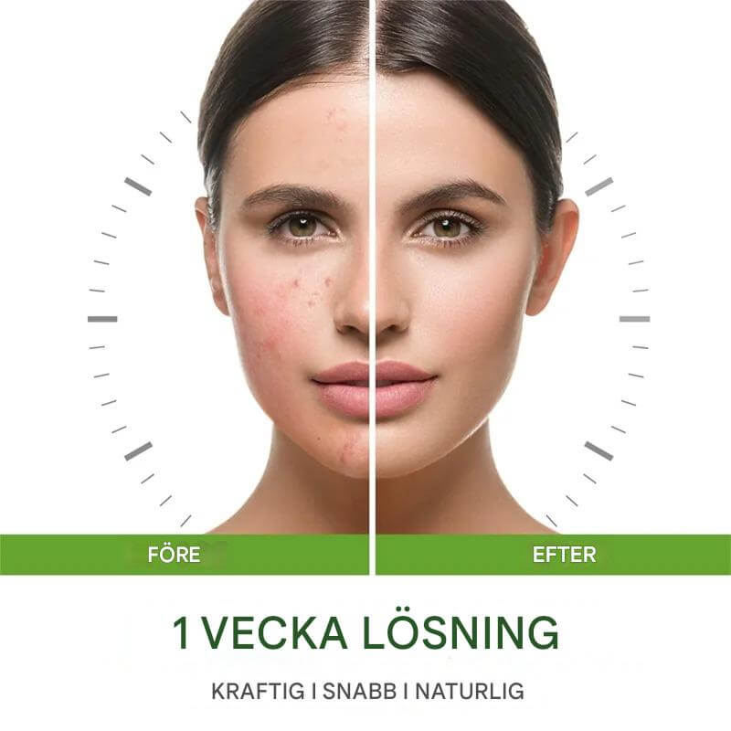 GrönRoa - Vegan gezichtscrème met tea tree voor een kalmere, evenwichtigere huid