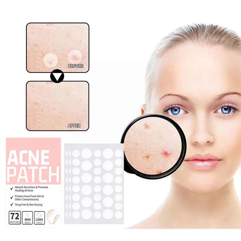 PoreClean - Acne Patch met Hydrocolloid voor een gezonde huid in één nacht