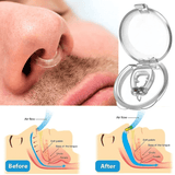 Anti-snurk Magnetische Silicone Neusklem