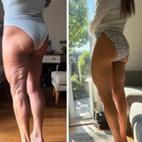 GlowCup - Cellulitisverwijderaar en huidversteviging met rood licht en Cuppingtherapie