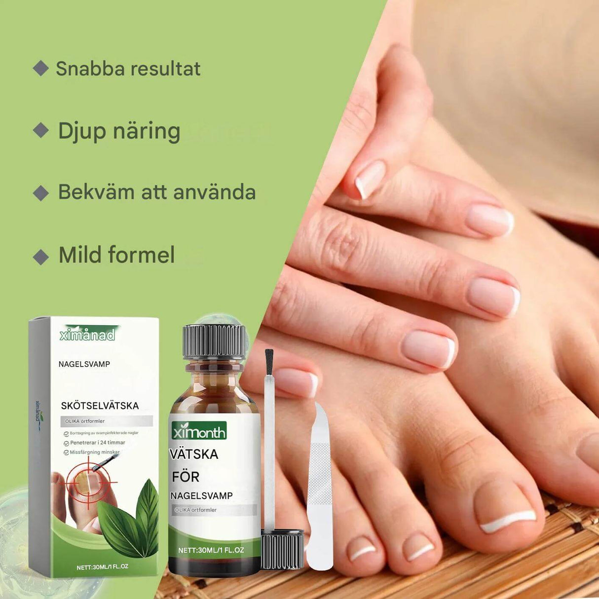 OnyFix - Behandeling van schimmelnagels en herstel van de nagelgezondheid