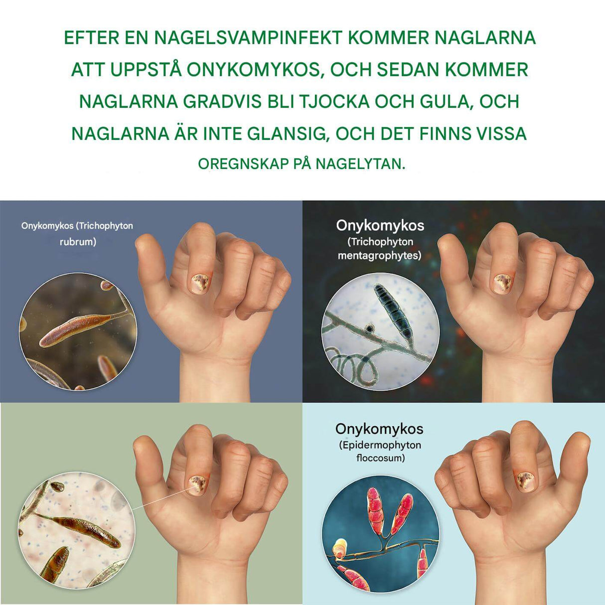 FungiClear - serum tegen schimmelnagels | Effectieve nagelverzorging voor sterkere nagels