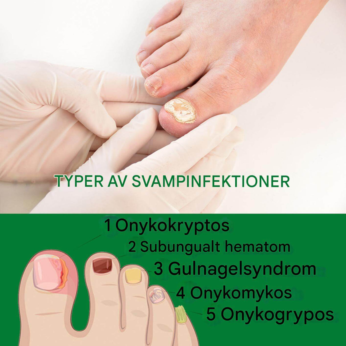 FungiClear - serum tegen schimmelnagels | Effectieve nagelverzorging voor sterkere nagels