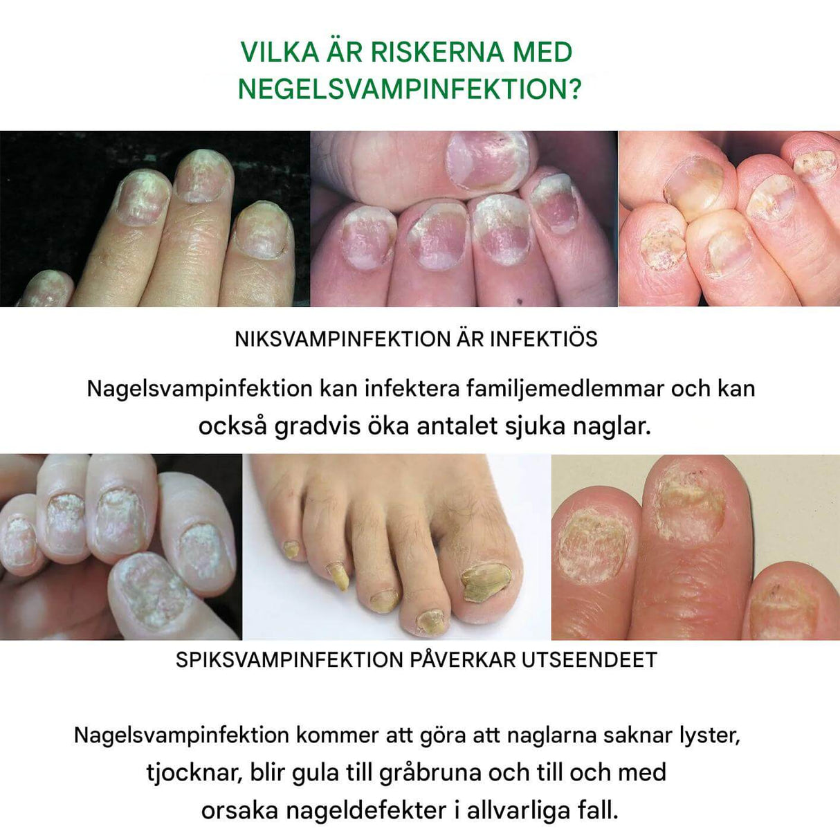 FungiClear - serum tegen schimmelnagels | Effectieve nagelverzorging voor sterkere nagels