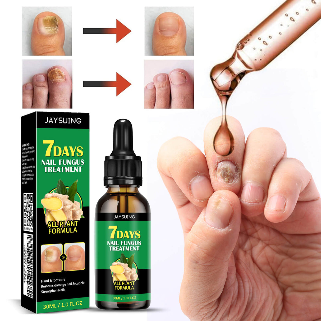 FungiClear - serum tegen schimmelnagels | Effectieve nagelverzorging voor sterkere nagels