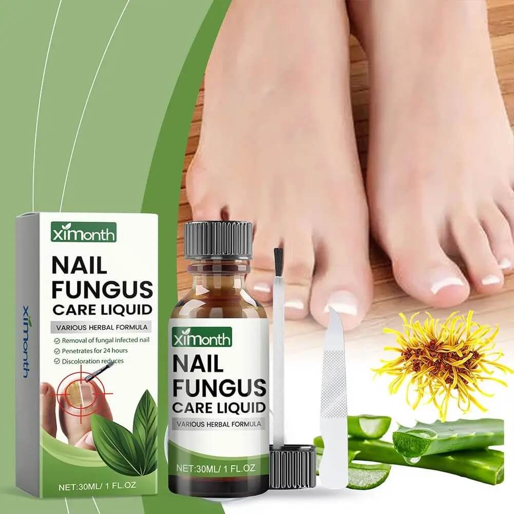 OnyFix - Behandeling van schimmelnagels en herstel van de nagelgezondheid