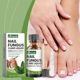 OnyFix - Behandeling van schimmelnagels en herstel van de nagelgezondheid