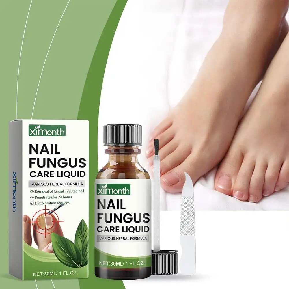 OnyFix - Behandeling van schimmelnagels en herstel van de nagelgezondheid