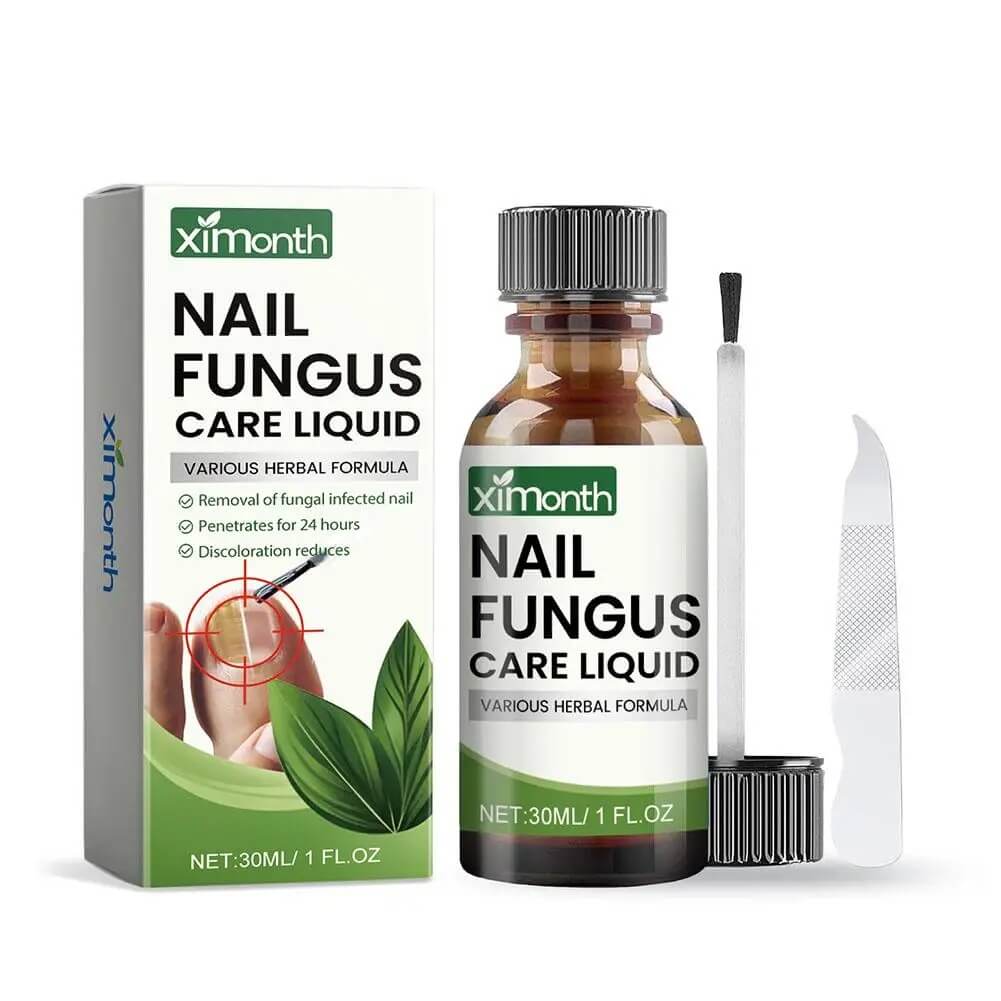 OnyFix - Behandeling van schimmelnagels en herstel van de nagelgezondheid